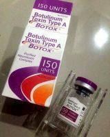 Botox 150 Units