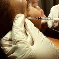 Botox For Crow's Feet