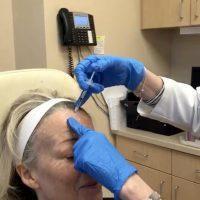 Onabotulinumtoxina Injection Photo