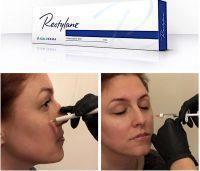 Restylane Silk Injectable Gel