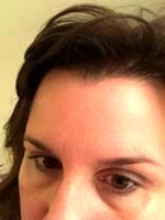 BOTOX Is A Protein Serum