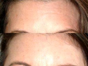 Botox Gateway Aesthetic Institute And Laser Center,Salt Lake City