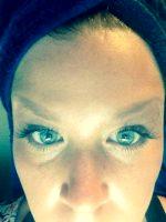 Botox Works By Preventing The Release Of Acetylcholine