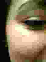 Dr Brian C. Reuben, Salt Lake City Plastic Surgeon Botox Crows Feet