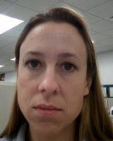 Dr Kimberly Butterwick, San Diego Plastic Surgeon Botulinum Injection