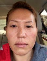 Injectables Are Not Highly Regulated