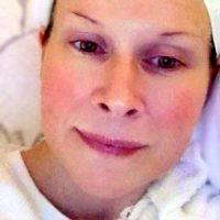 Is BOTOX In West Palm Beach Right For Me