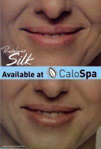 Restylane Silk By M. Bradley Calobrace, MD, FACS, Plastic Surgeon In Northfield, Kentucky