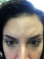 The Injectable May Get A Bad Reputation When The Problem Actually Lies With The Injector And Not The Product