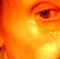 WHAT ARE THE BENEFITS OF BOTOX