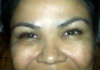 When Do I See Results And How Long Do They Last