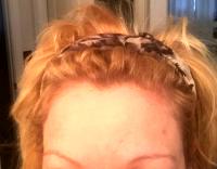 BOTOX Cosmetic From The Plastic Surgery Center Near Baltimore