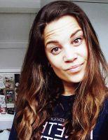 BOTOX Is Very Effective And Results Last Three To Four Months