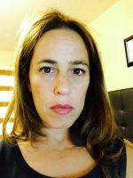 Botox Injections Beverly Hills