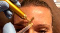 Botox Plastic Surgery By Dr. Parker A. Velargo, New Orleans Plastic Surgeon