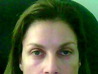 Botox Requires No Surgery