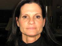 Botox Shots With Dr Cory Torgerson, Toronto Plastic Surgeon