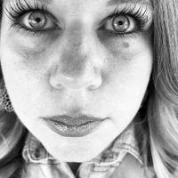 Botox Surgery New Orleans