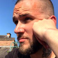 Botox Temporarily Relaxes Facial Muscles That Cause Wrinkles