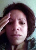 Botox Treatment Keeps Your Forehead Muscles In A Relaxed State