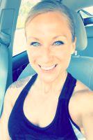 Dr Rikesh T. Parikh, Seattle Plastic Surgeon Botox Shots Patient Result