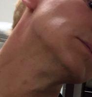 Dr. Well Medical Arts, Seattle Plastic Surgeon Botox Toxin