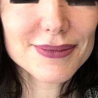 Maximum Results Achieved In 1 2 Weeks