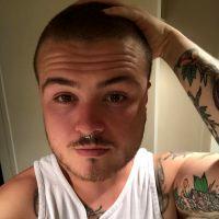 Plan Your BOTOX Injections Properly