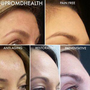 Reduce The Appearance Of Fine Lines And Wrinkles By George Gavrila, MD,Baltimore