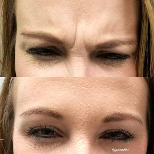 Those Pesky 11 Lines Were Setting Up Shop To Stay, Even When She Wasn't Making Facial Expressions!