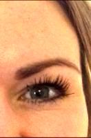 Toronto Botox And Fillers